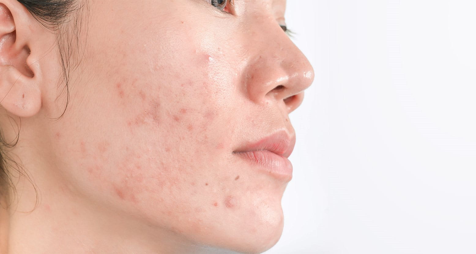 Finding the right care for your skin