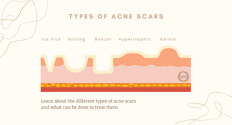 Finding the right care for your skin
